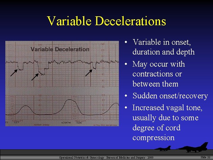 Variable Decelerations • Variable in onset, duration and depth • May occur with contractions
