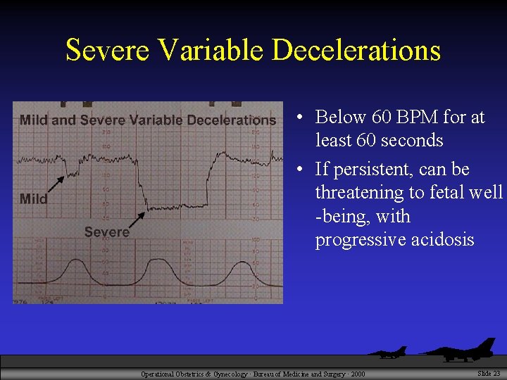 Severe Variable Decelerations • Below 60 BPM for at least 60 seconds • If