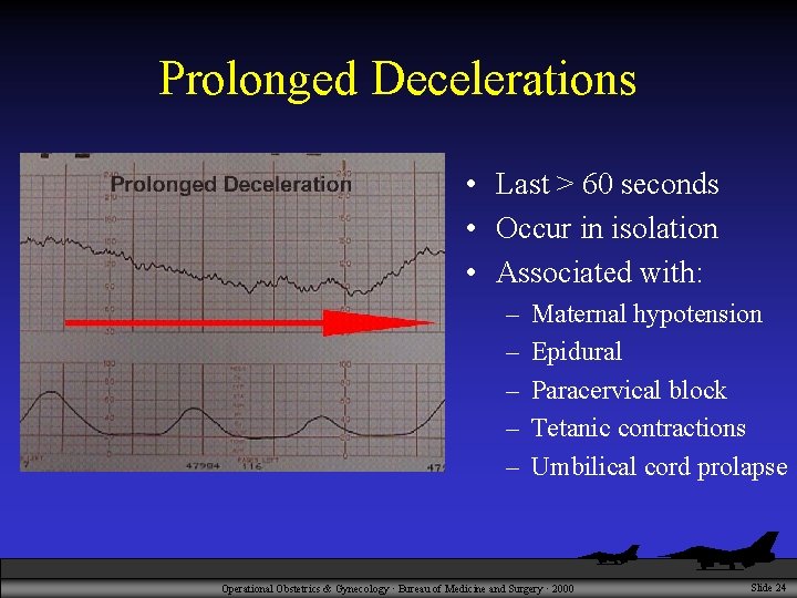 Prolonged Decelerations • Last > 60 seconds • Occur in isolation • Associated with: