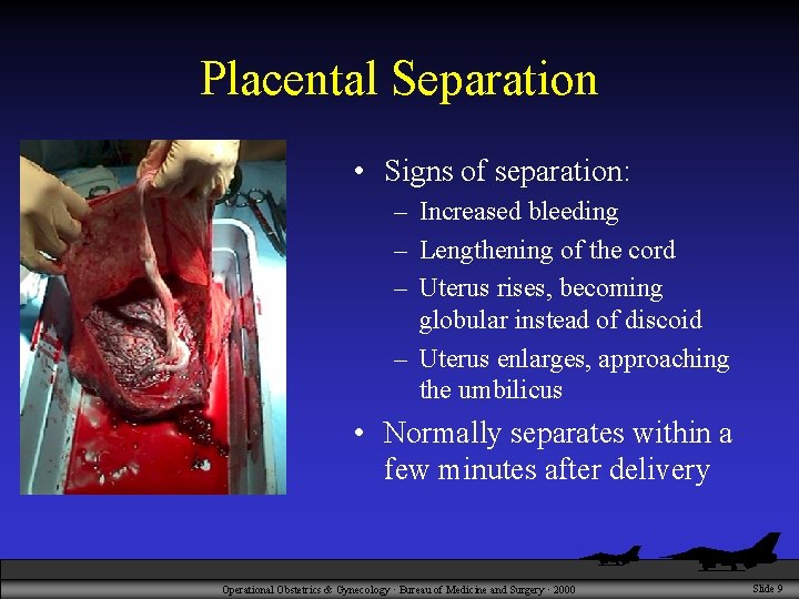 Placental Separation • Signs of separation: – Increased bleeding – Lengthening of the cord
