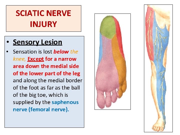 SCIATIC NERVE INJURY • Sensory Lesion • Sensation is lost below the knee, Except