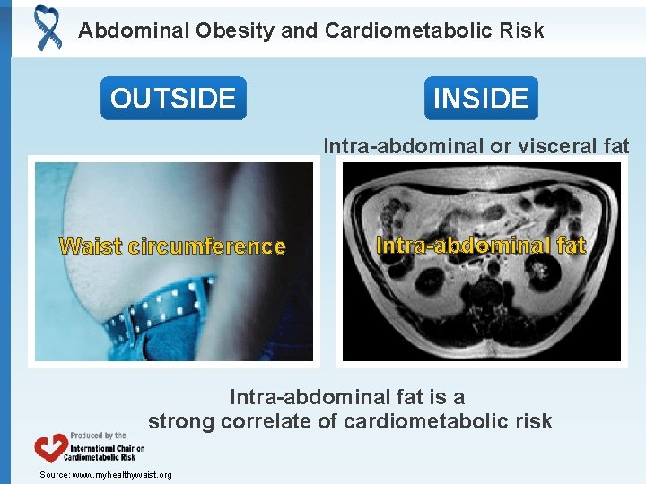 Abdominal Obesity and Cardiometabolic Risk OUTSIDE INSIDE Intra-abdominal or visceral fat Waist circumference Intra-abdominal