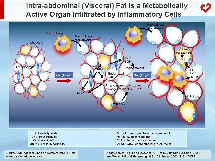 Intra-abdominal (Visceral) Fat is a Metabolically Active Organ Infiltrated by Inflammatory Cells Macrophage recruitment