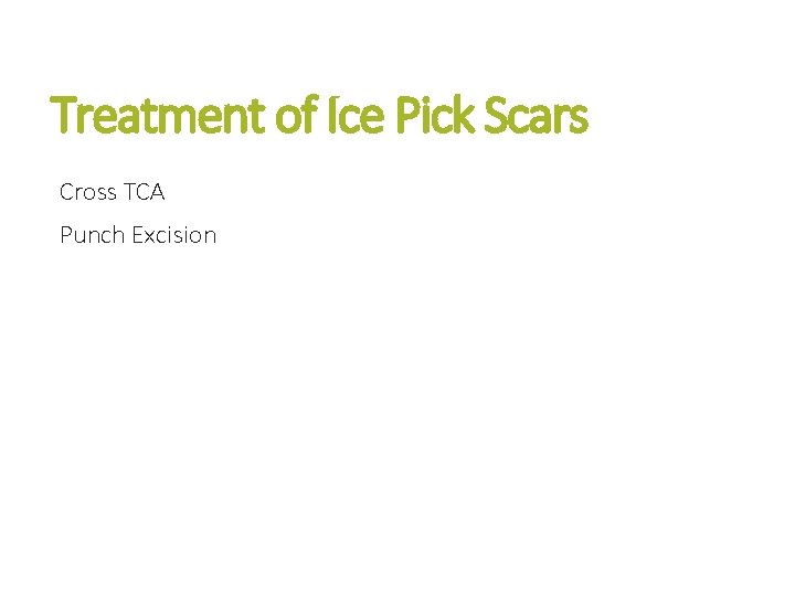 Treatment of Ice Pick Scars Cross TCA Punch Excision 