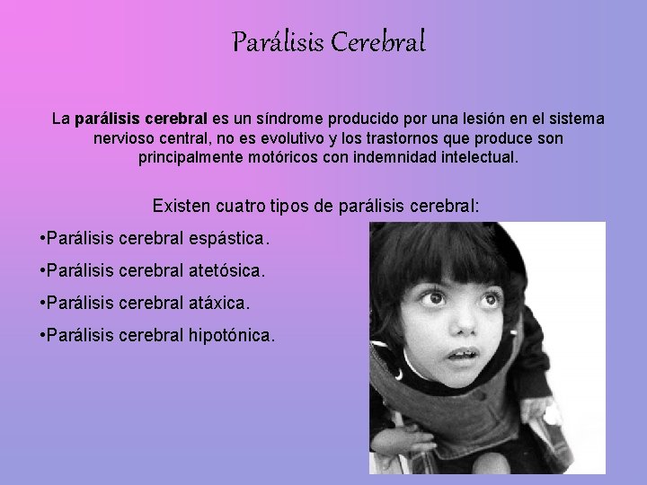 Parálisis Cerebral La parálisis cerebral es un síndrome producido por una lesión en el