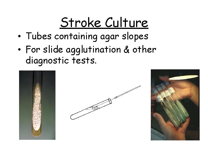 Stroke Culture • Tubes containing agar slopes • For slide agglutination & other diagnostic