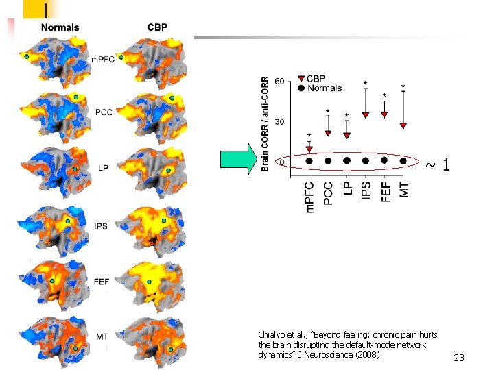 ~1 Chialvo et al. , “Beyond feeling: chronic pain hurts the brain disrupting the