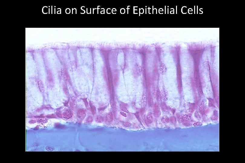Cilia on Surface of Epithelial Cells 
