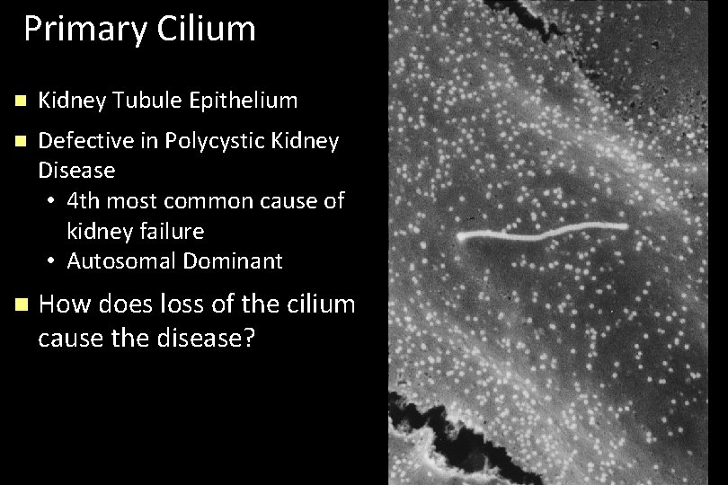 Primary Cilium n Kidney Tubule Epithelium n Defective in Polycystic Kidney Disease • 4