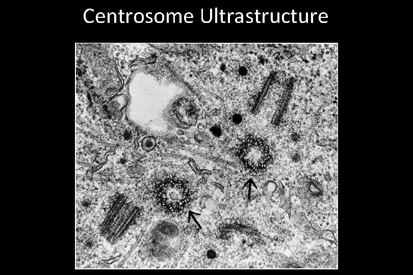 Centrosome Ultrastructure 