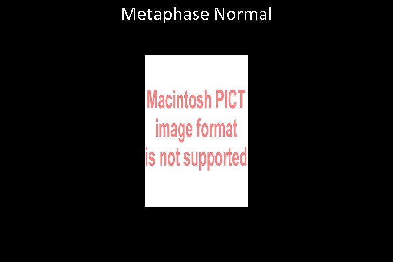 Metaphase Normal 