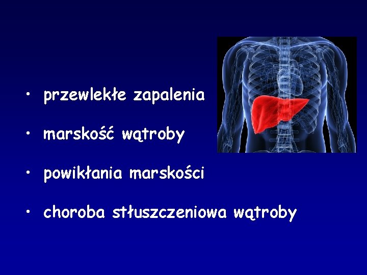  • przewlekłe zapalenia • marskość wątroby • powikłania marskości • choroba stłuszczeniowa wątroby