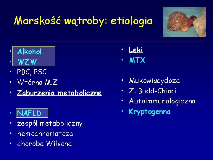 Marskość wątroby: etiologia • • • Alkohol WZW PBC, PSC Wtórna M. Ż Zaburzenia