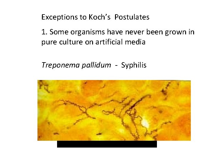 Exceptions to Koch’s Postulates 1. Some organisms have never been grown in pure culture