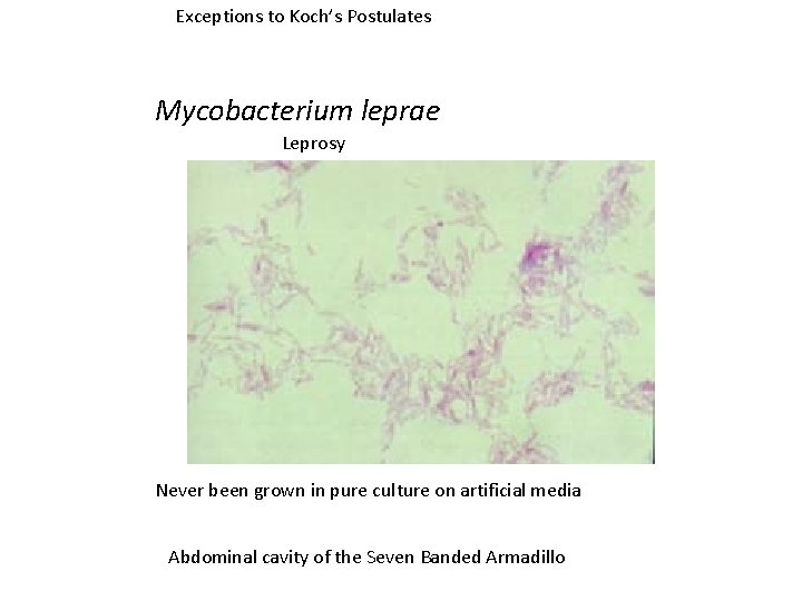 Exceptions to Koch’s Postulates Mycobacterium leprae Leprosy Never been grown in pure culture on