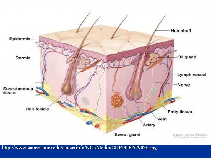 http: //www. cancer. umn. edu/cancerinfo/NCI/Media/CDR 0000579036. jpg 