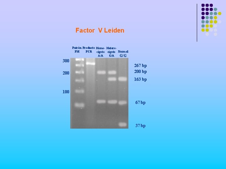 Factor V Leiden Patrón Producto Homo- Hetero. PM PCR cigoto Normal G/A A/A G/G