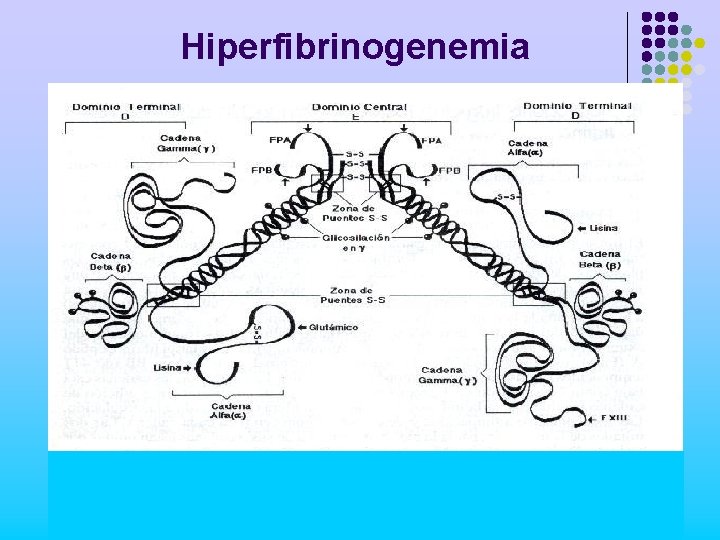 Hiperfibrinogenemia 