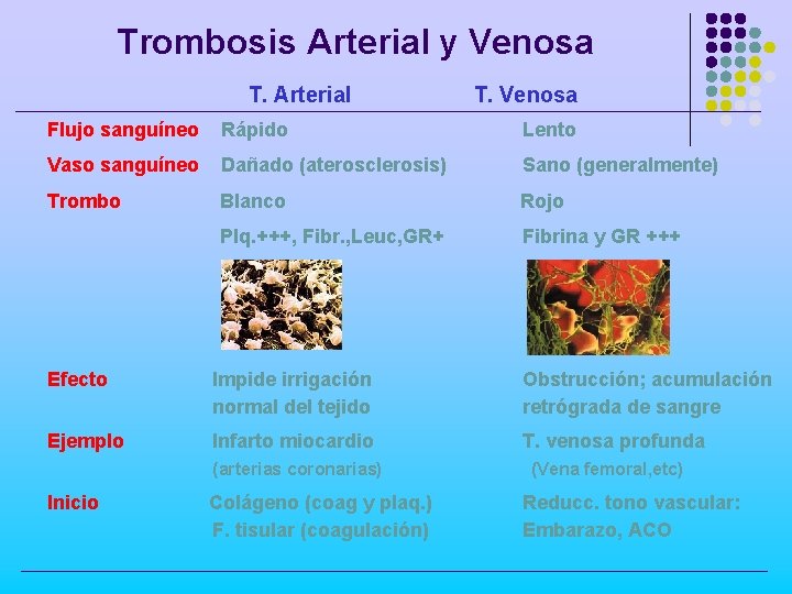 Trombosis Arterial y Venosa T. Arterial T. Venosa Flujo sanguíneo Rápido Lento Vaso sanguíneo