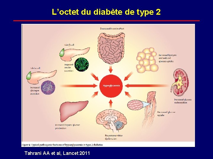 L’octet du diabète de type 2 Tahrani AA et al, Lancet 2011 