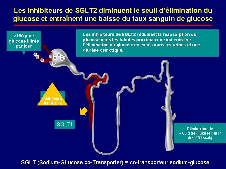 Les inhibiteurs de SGLT 2 diminuent le seuil d’élimination du glucose et entraînent une