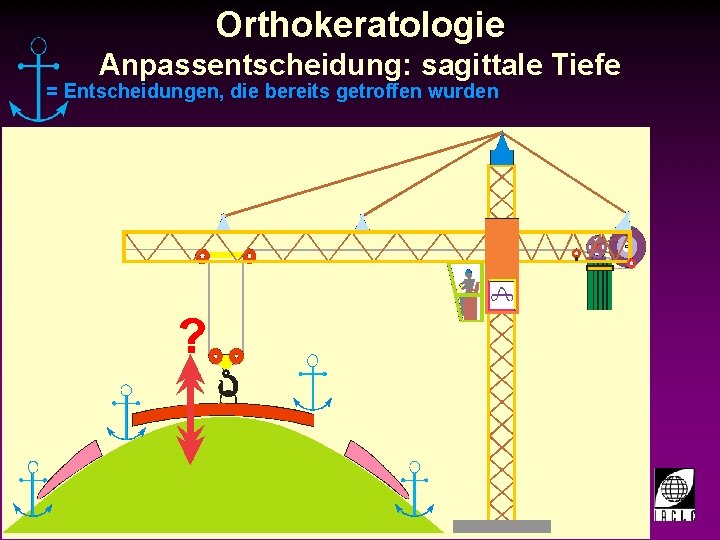 Orthokeratologie Anpassentscheidung: sagittale Tiefe = Entscheidungen, die bereits getroffen wurden ? 998700 -25 S.