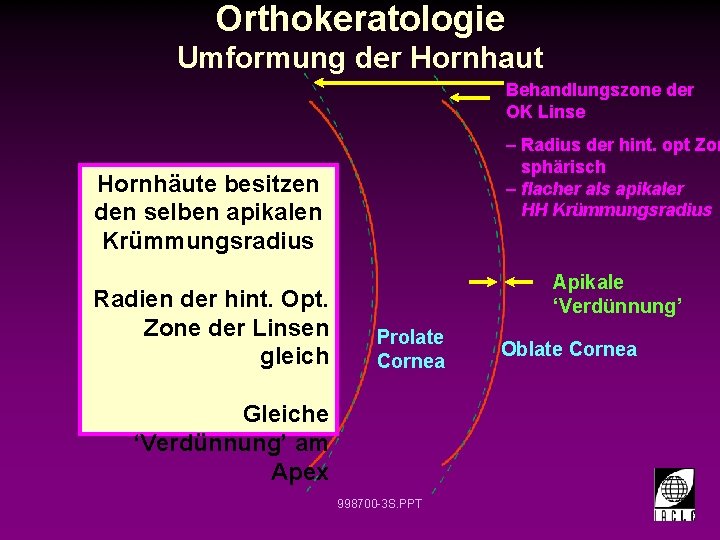 Orthokeratologie Umformung der Hornhaut Behandlungszone der OK Linse – Radius der hint. opt Zon