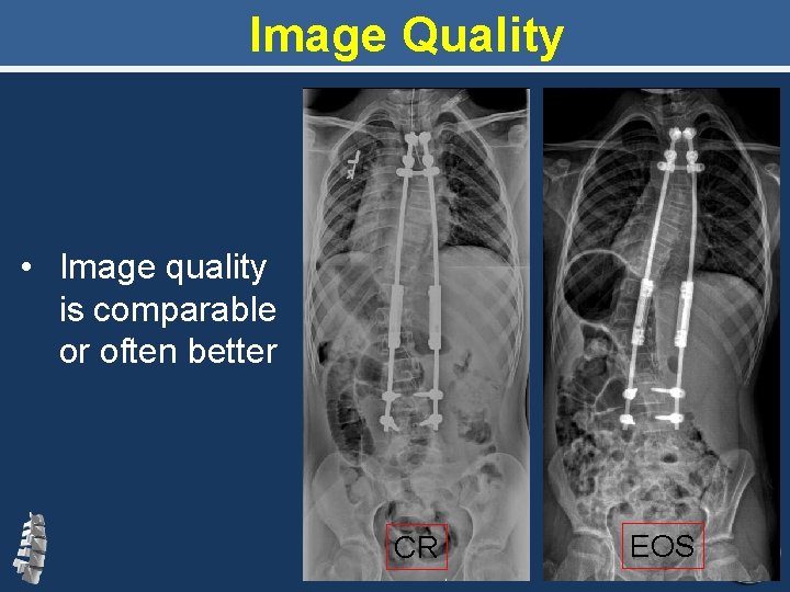 Image Quality • Image quality is comparable or often better CR EOS 