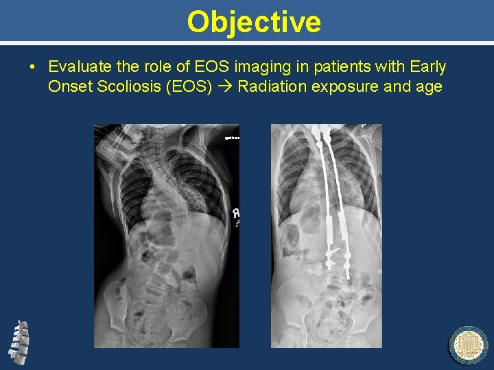 Objective • Evaluate the role of EOS imaging in patients with Early Onset Scoliosis