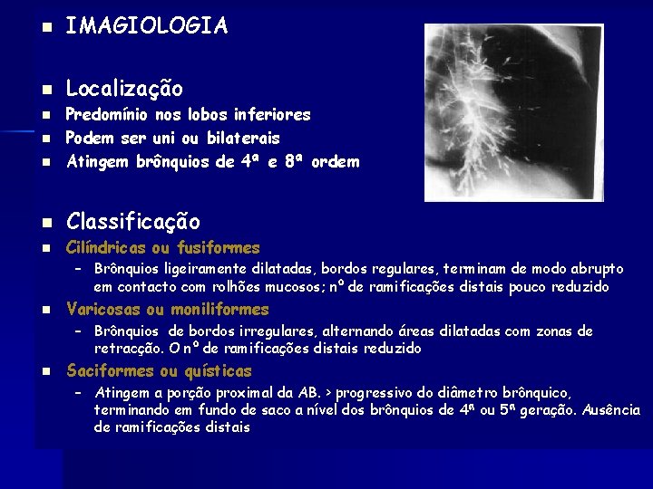 n IMAGIOLOGIA n Localização n Predomínio nos lobos inferiores Podem ser uni ou bilaterais