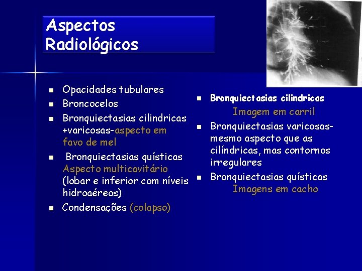 Aspectos Radiológicos n n n Opacidades tubulares Broncocelos Bronquiectasias cilindricas +varicosas-aspecto em favo de