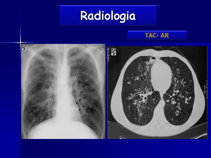 Radiologia TAC- AR 