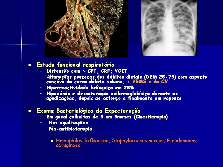 n Estudo funcional respiratório n Exame Bacteriológico da Expectoração – Distensão com > CPT,