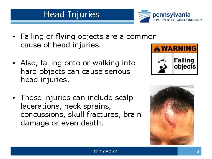 Head Injuries • Falling or flying objects are a common cause of head injuries.