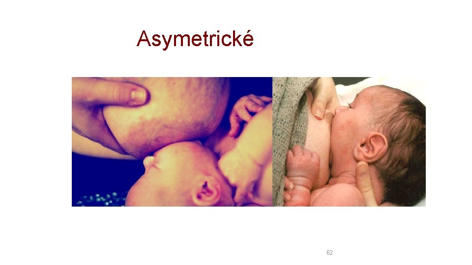 Asymetrické 62 