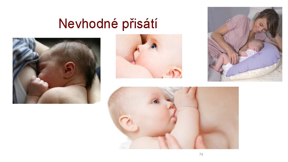 Nevhodné přisátí 74 