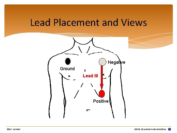 Lead Placement and Views Negative Ground Lead III Positive 2014 Version OBHG Education Subcommittee Lead Placement and Views Negative Ground Lead III Positive 2014 Version OBHG Education Subcommittee