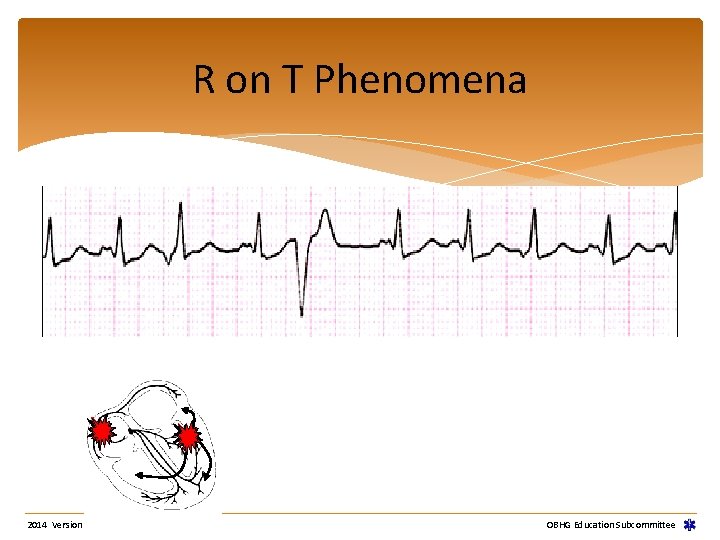 R on T Phenomena 2014 Version OBHG Education Subcommittee R on T Phenomena 2014 Version OBHG Education Subcommittee