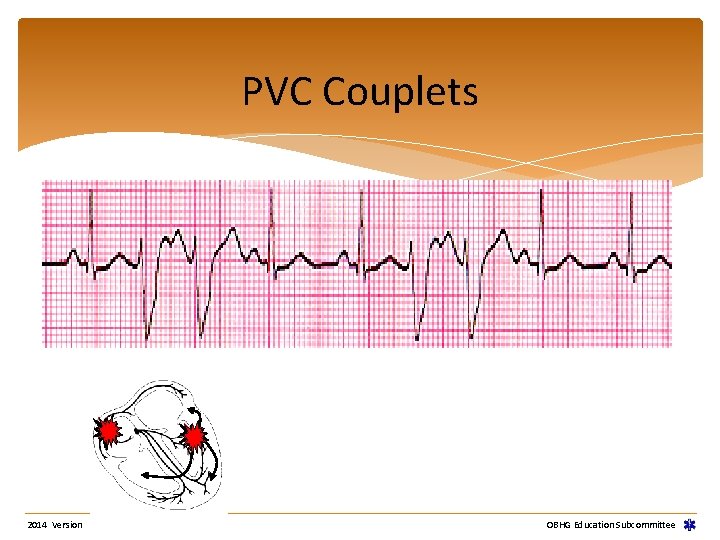 PVC Couplets 2014 Version OBHG Education Subcommittee PVC Couplets 2014 Version OBHG Education Subcommittee