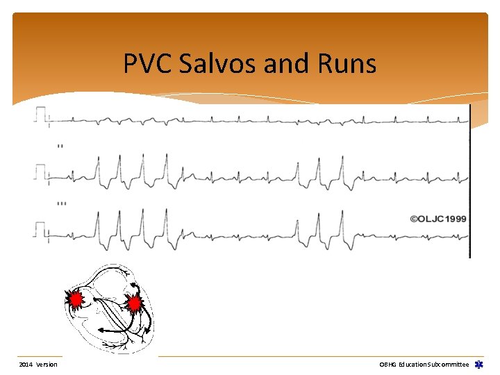 PVC Salvos and Runs 2014 Version OBHG Education Subcommittee PVC Salvos and Runs 2014 Version OBHG Education Subcommittee