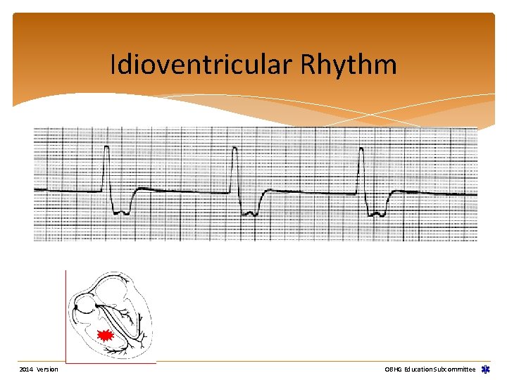 Idioventricular Rhythm 2014 Version OBHG Education Subcommittee Idioventricular Rhythm 2014 Version OBHG Education Subcommittee
