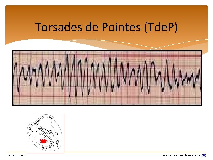 Torsades de Pointes (Tde. P) 2014 Version OBHG Education Subcommittee Torsades de Pointes (Tde. P) 2014 Version OBHG Education Subcommittee