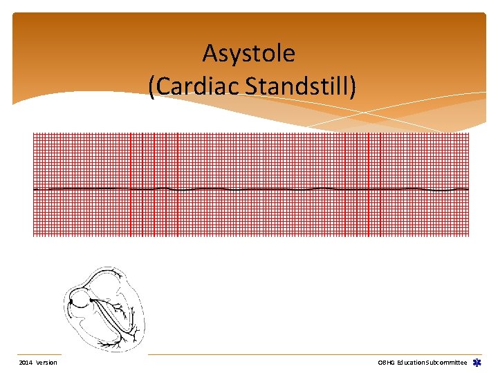 Asystole (Cardiac Standstill) 2014 Version OBHG Education Subcommittee Asystole (Cardiac Standstill) 2014 Version OBHG Education Subcommittee