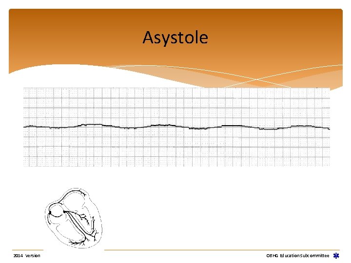 Asystole 2014 Version OBHG Education Subcommittee Asystole 2014 Version OBHG Education Subcommittee