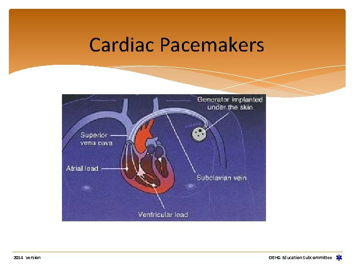 Cardiac Pacemakers 2014 Version OBHG Education Subcommittee Cardiac Pacemakers 2014 Version OBHG Education Subcommittee