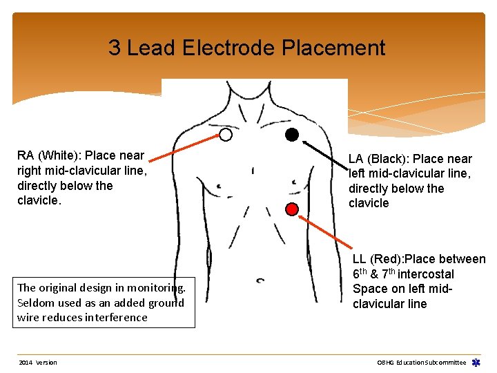 3 Lead Electrode Placement RA (White): Place near right mid-clavicular line, directly below the 3 Lead Electrode Placement RA (White): Place near right mid-clavicular line, directly below the