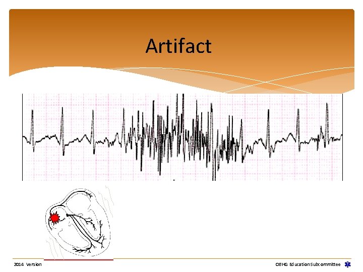 Artifact 2014 Version OBHG Education Subcommittee Artifact 2014 Version OBHG Education Subcommittee
