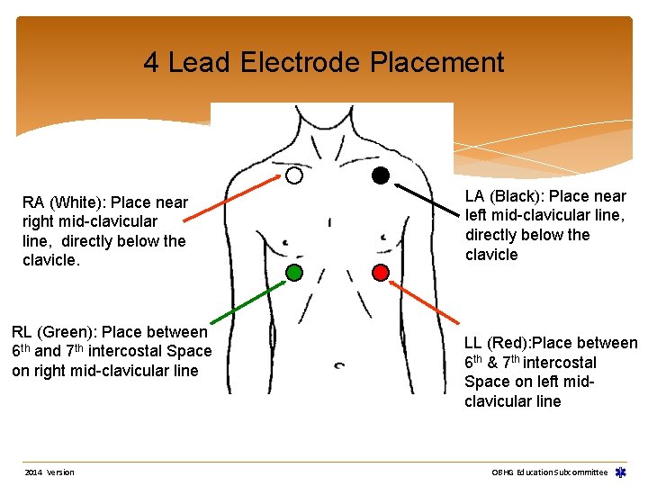 4 Lead Electrode Placement RA (White): Place near right mid-clavicular line, directly below the 4 Lead Electrode Placement RA (White): Place near right mid-clavicular line, directly below the