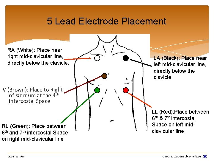 5 Lead Electrode Placement RA (White): Place near right mid-clavicular line, directly below the 5 Lead Electrode Placement RA (White): Place near right mid-clavicular line, directly below the