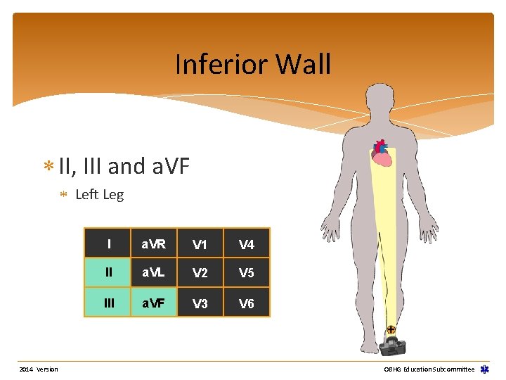Inferior Wall II, III and a. VF Left Leg 2014 Version I a. VR Inferior Wall II, III and a. VF Left Leg 2014 Version I a. VR
